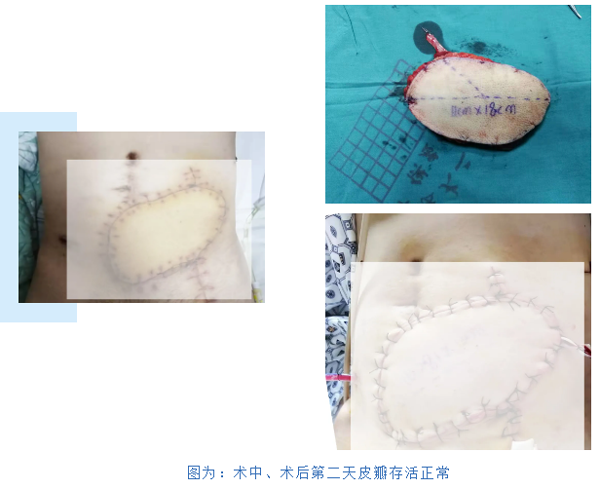 积极救治,永不放弃——贵医大二院普外科联合口腔颌面