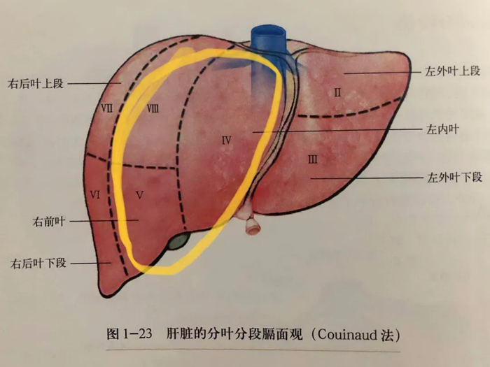 【新技术】贵医大二院开展一例肝中叶切除术